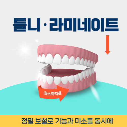수원치과 수원시 치과 틀니 라미네이트