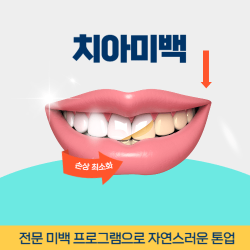 수원치과 수원시 치과 치아미백