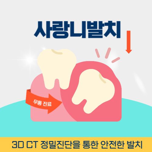 수원치과 수원시 치과 사랑니 발치