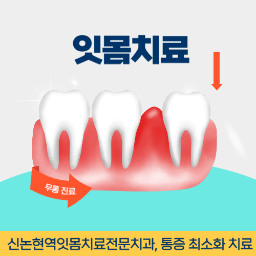 수원치과 수원시 치과 잇몸치료